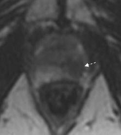Irm de la prostate « Retour examens