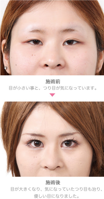 Volume39 栃木県の美容外科 美容整形 宇都宮竹内クリニック