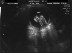 20 Weeks, 2 Days (08.09.07)