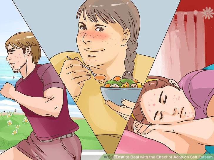 Deal with the Effect of Acne on Self Esteem Step 11.jpg