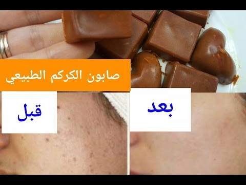 صورة