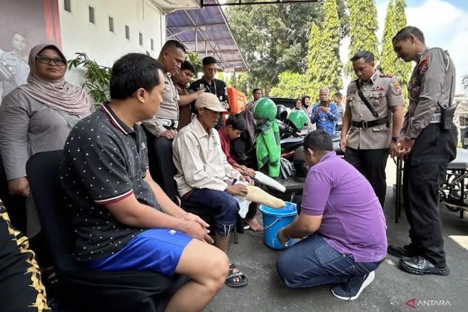 Polresta Malang Kota fasilitasi pembuatan kaki palsu untuk disabilitas