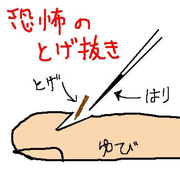 朝メシ前 とげ抜きコワイ