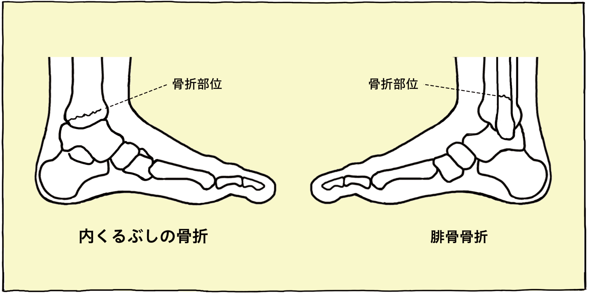 足首が痛い 原因 と 場所 から分類 解説 対処法 足のお悩み百科
