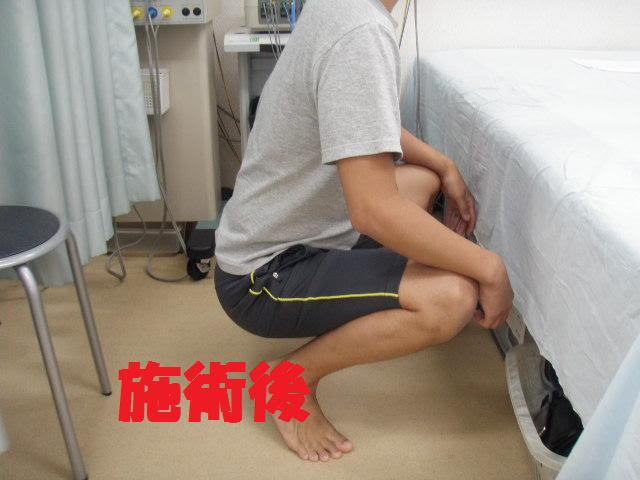 大阪和泉市 きつい 尾てい骨の痛み 座る時の痛みを 無痛整体 でどこよりも早く回復 染井鍼灸整骨院