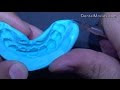 how to do index tray for dental mock up