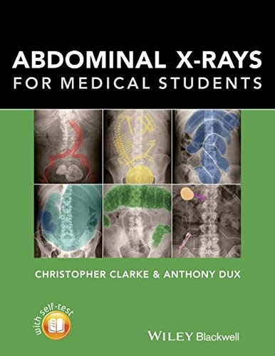 Abdominal X-rays for Medical Students, by Christopher Clarke, Anthony Dux