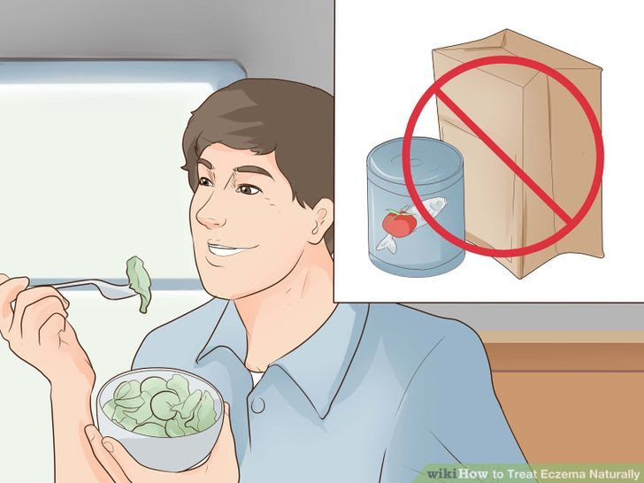 Treat Eczema Naturally Step 15 Version 3.jpg