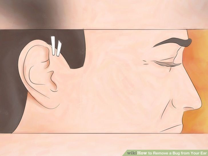 Remove a Bug from Your Ear Step 1 Version 2.jpg