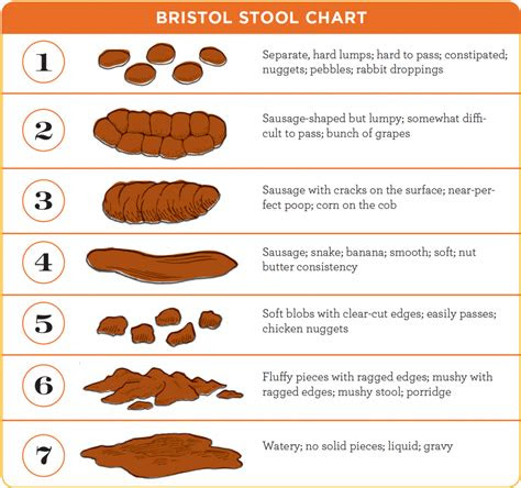 There can be various causes for pale stools in children, including diet, medications, biliary problems and hepatitis. pin on school