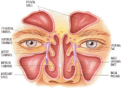 Sinusitis Cks