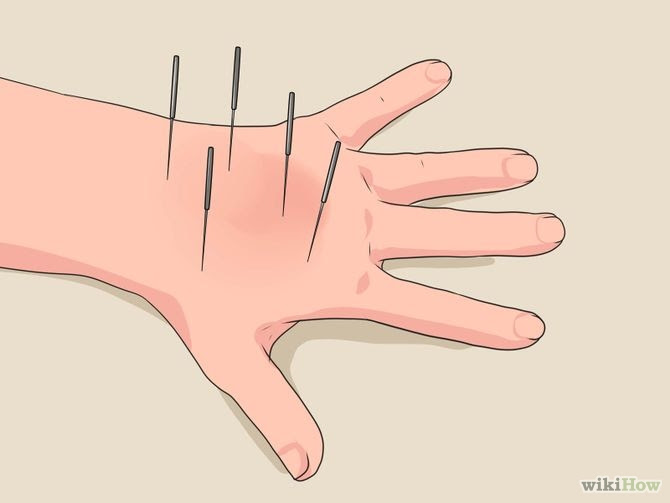 Reduce Edema Naturally Step 18 Version 2.jpg