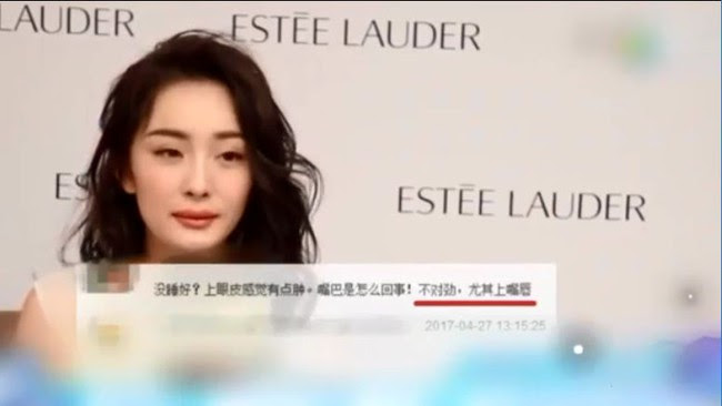  Yang Mi mắt hông, mỗi TEU, bị nghi ngờ phẫu thuật thẩm mỹ trên khuôn mặt vô cảm - ảnh 4. "title =" mắt hip Yang Mi, môi TEU, bị nghi ngờ phẫu thuật thẩm mỹ trên khuôn mặt vô cảm - ảnh 4. "rel =" lightbox "PHOTOID = "b6bff680-2c02-11e7-B630-eb19d879ac9b" type = "ảnh" style = "max-width: 100%; "Dữ liệu ban đầu =" http://ift.tt/2prjCzs "width =" "height =" "> </div> <div class=