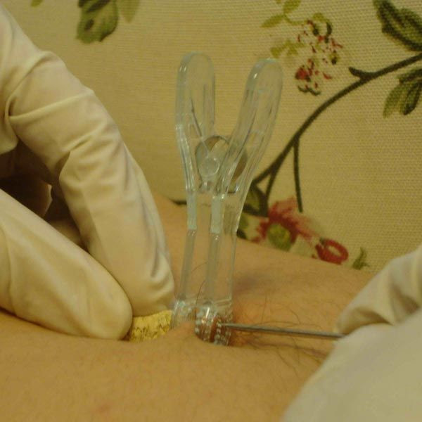 Sterile Navel Ring Rings Body Piercing Belly Button ...