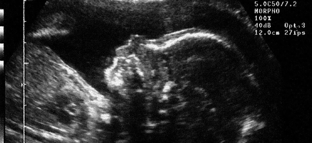 L Echographie Un Bon Moyen D Annoncer Une Grossesse Et De Presenter Le Futur Bebe Slate Fr