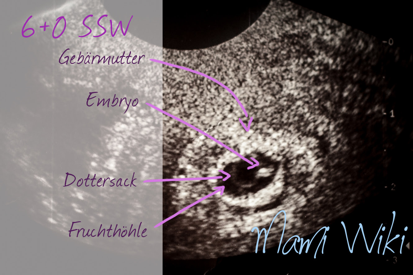 Dein Baby Im Ultraschall Mamiwiki