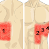 Organ Under The Rib Back On The Right Side / 14 Common Causes of Pain Under Right Rib Cage : As mentioned, causes of right rib cage tenderness vary from simple musculoskeletal pain to severe organ injury.