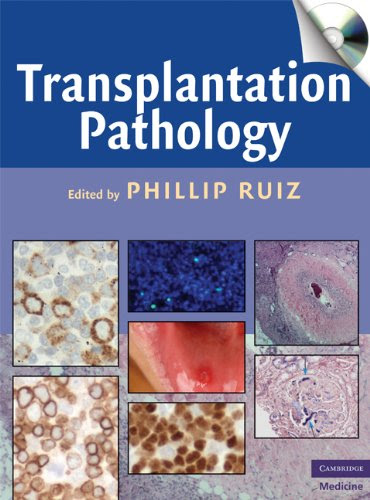 Transplantation Pathology (Cambridge Medicine (Hardcover))From Brand: Cambridge University Press