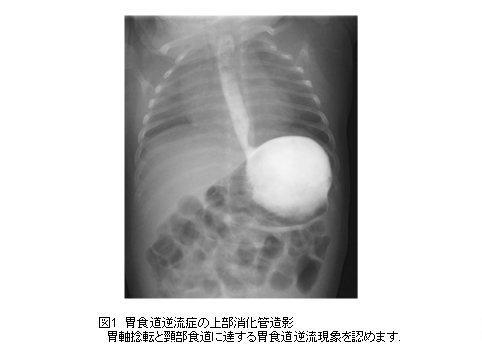乳幼児の在宅医療を支援するサイト 日本小児在宅医療支援研究会