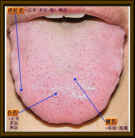 ツムラ 柴苓湯 エキス顆粒 医療用 114 効能効果 弁証論治 舌診等 ハル薬局 2頁目