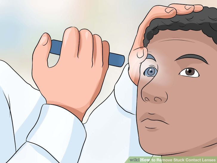 Remove Stuck Contact Lenses Step 25.jpg