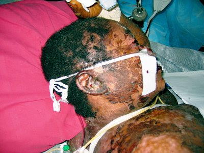 Skin Whitening Injections in Africa - African Health Magazine