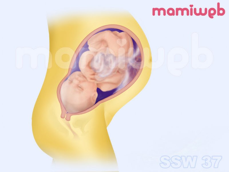 37 Schwangerschaftswoche 37 Ssw Mamiweb De