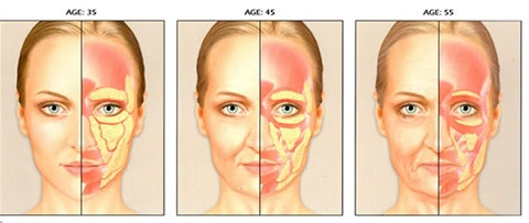 cấy mỡ trẻ hóa mắt 6