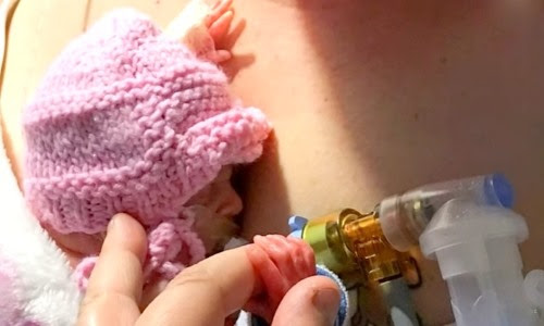 preemie baby