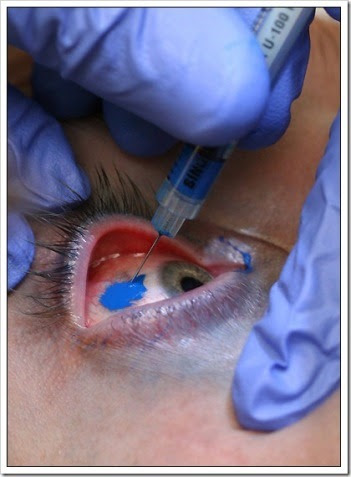  their eye, 