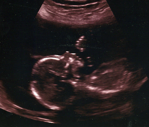 baby1