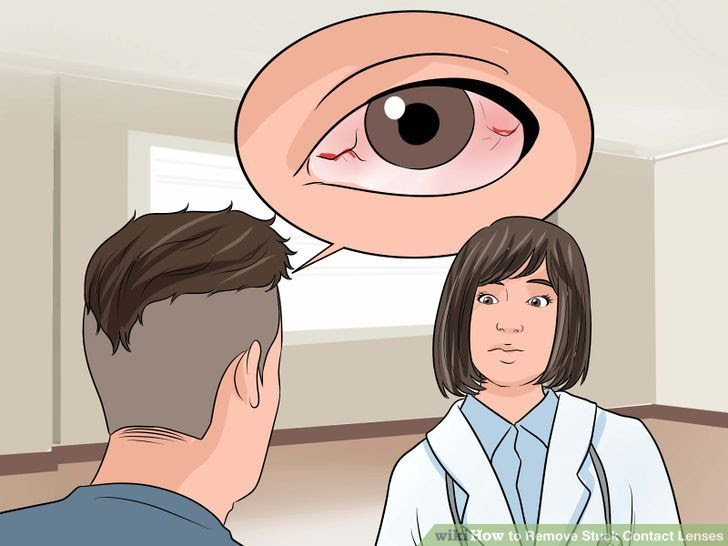 Remove Stuck Contact Lenses Step 26.jpg