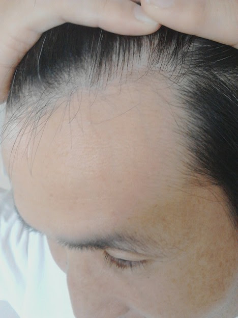 不思議なことに 最近 髪の生え際が前進してきてる 孫正義に言わせ 写真共有サイト フォト蔵