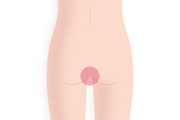 デリケートゾーン Vio ってどんな形 みんなどこまで脱毛してるの 美容脱毛サロン ミュゼプラチナム
