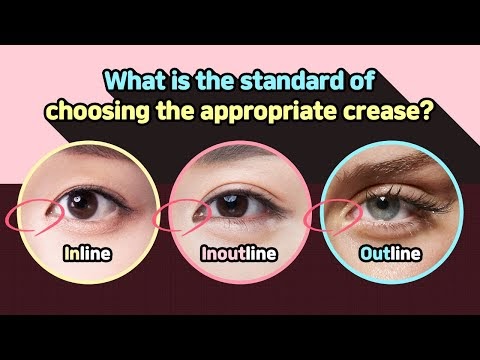 What is the standard of choosing the appropriate double eyelid crease?