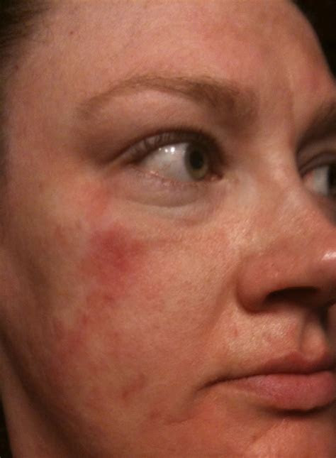 Can be used for face and body. blahgblahgblahg: O hai! Iz u my dokter?