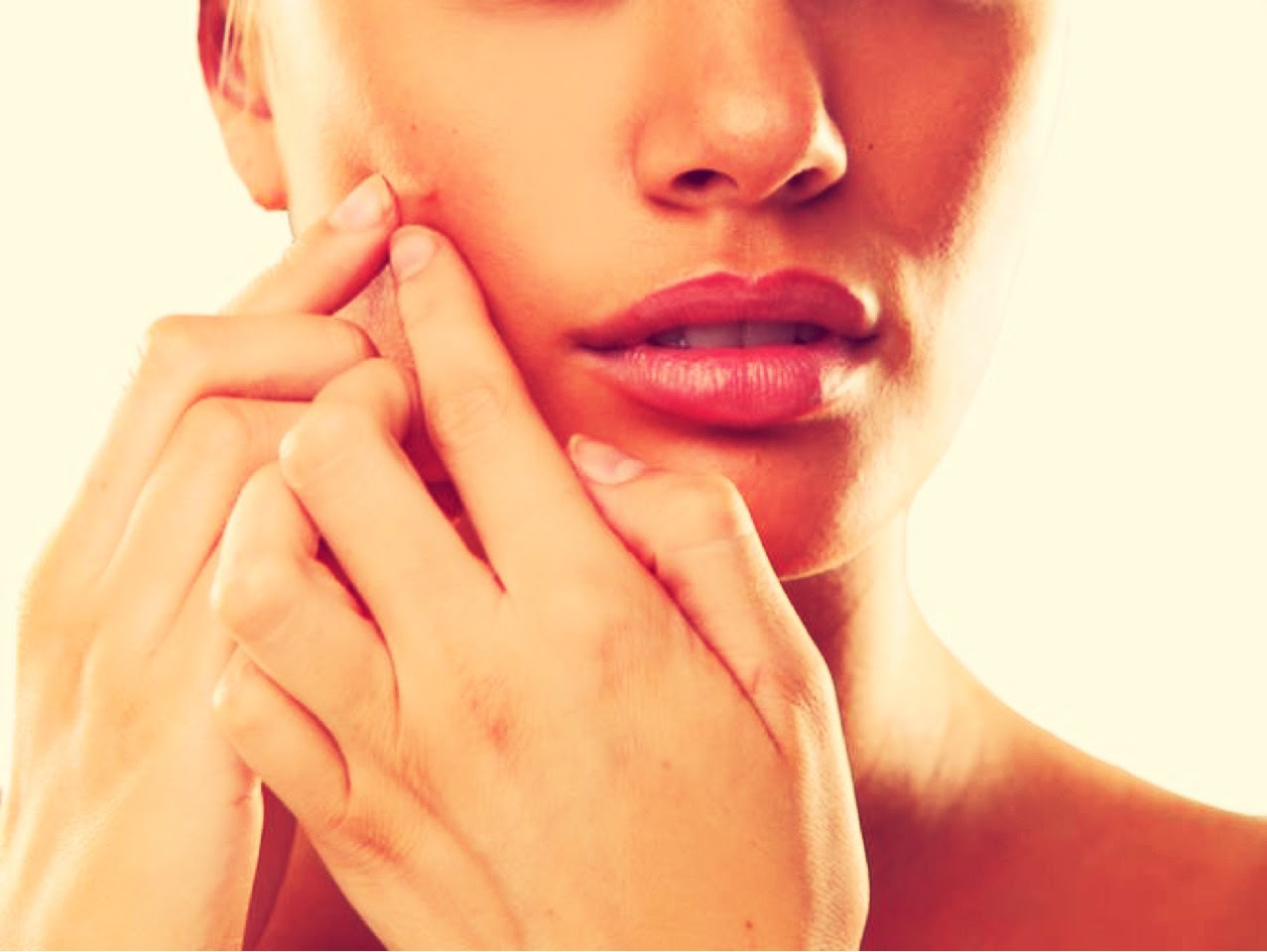 Get Rid Of Pimples - Musely