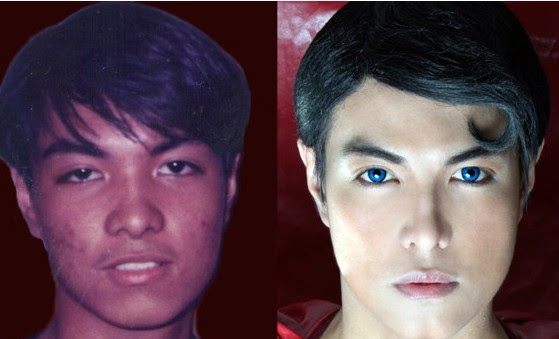 Before and After Injection Photos: Glutathione Skin Whitening Skin 