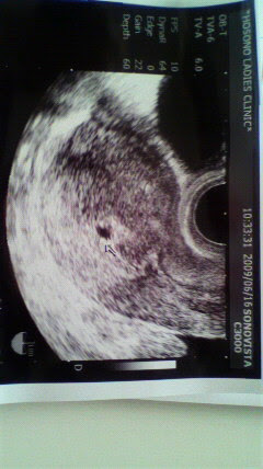 ５w2d まさかの妊娠 モモタニティ日記