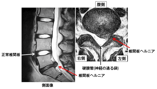 脊椎外科 医療法人 麻生整形外科病院