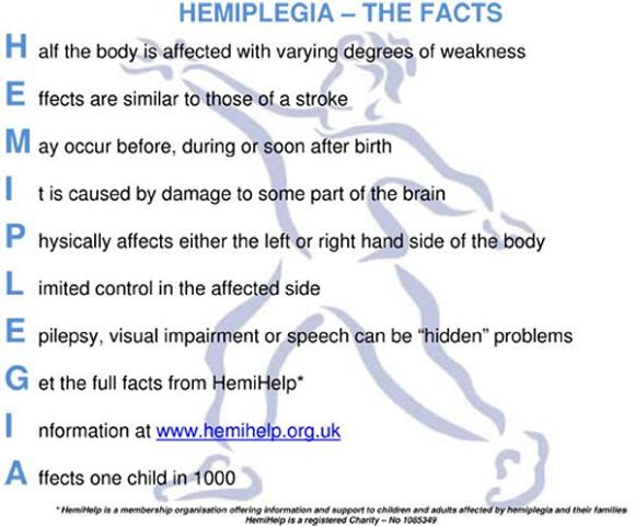 Kids Can Face Aphasia Caused by Hemiplegia: Treatment Options for Stroke-Like Damage to Children's Brains Kids Can Face Aphasia Caused by Hemiplegia: Treatment Options for Stroke-Like Damage to Children's Brains