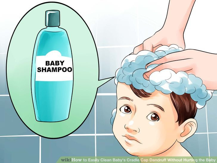 Easily Clean Baby's Cradle Cap Dandruff Without Hurting the Baby Step 2 Version 2.jpg