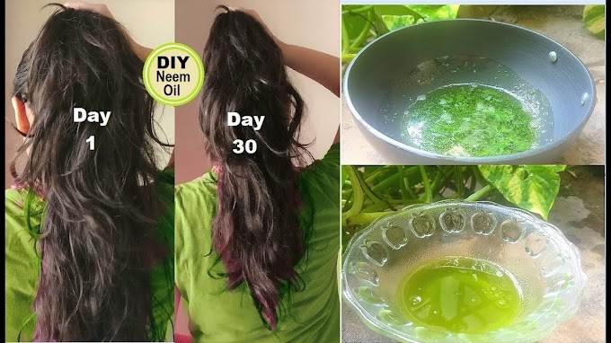 Hair Growth Gummies - Nzuri Little Bitties Children Hair Vitamin Gummy Bears are : Zinc plays a vital role in .