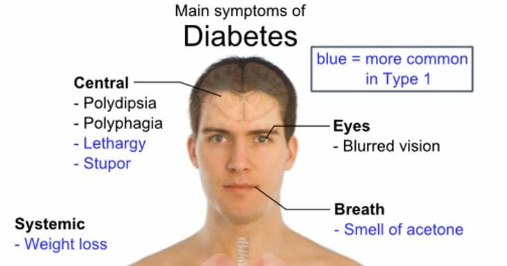 ... Between Diabetes and Eye Problems - Beaumont Vision - Beaumont Vision