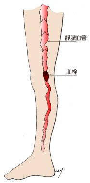 éèæ²å¼µæç¸å°è¨ºæ è¡æ 