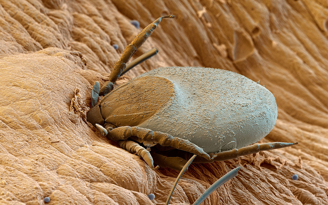 z4450498-tick_feeding_on_human_blood_sem