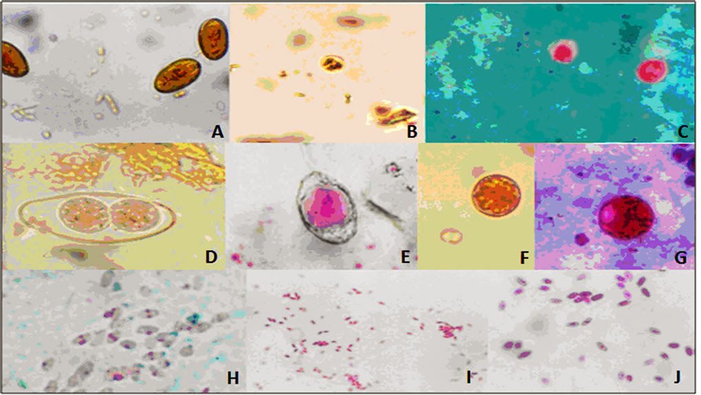 Frequency of Emerging Parasites in HIV/AIDS and Frequency of Emerging Parasites in HIV/AIDS and