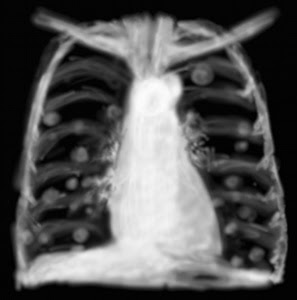 chimiothérapie relationsésithérapie