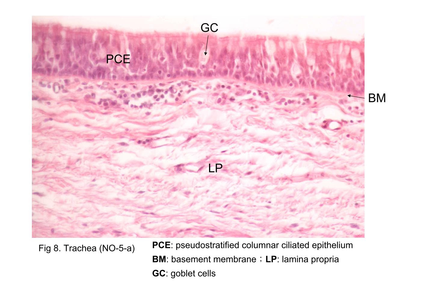 Block4 Fig 8 9 Trachea NO 5 A