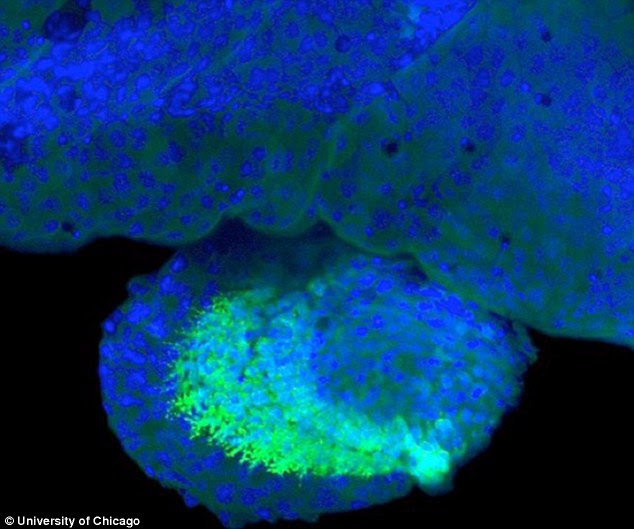 By studying the genes of a fish called the spotted gar, scientists have discovered  genetic 'switches' (shown in green) in  transgenic fish fins, meaning it has the potential to evolve into fingers and wrists. This image shows a view of a transgenic zebrafish pectoral fish fin with cell nuclei in blue and gene activity in green